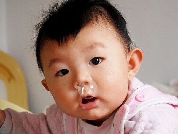 Bệnh viêm xoang mũi là bệnh thường gặp ở trẻ em phần 1